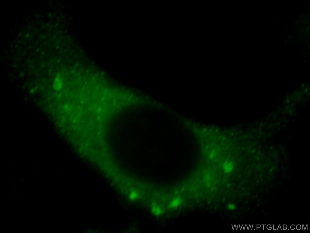 VIPAS39 Polyclonal antibody