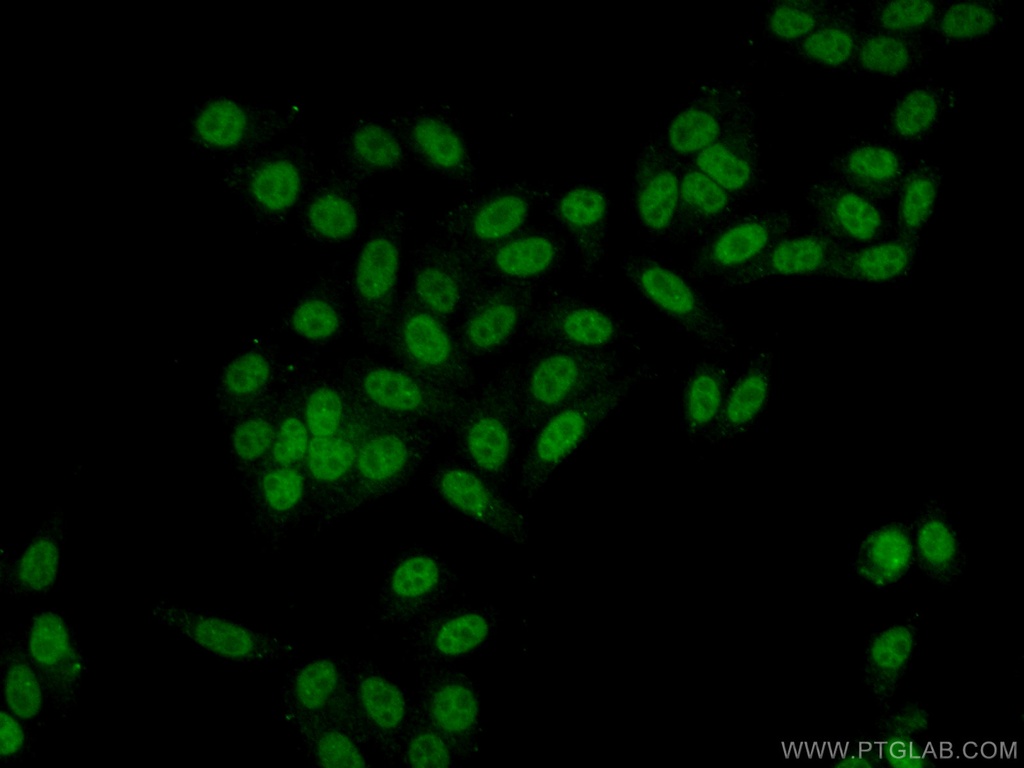 WDR55 Polyclonal antibody