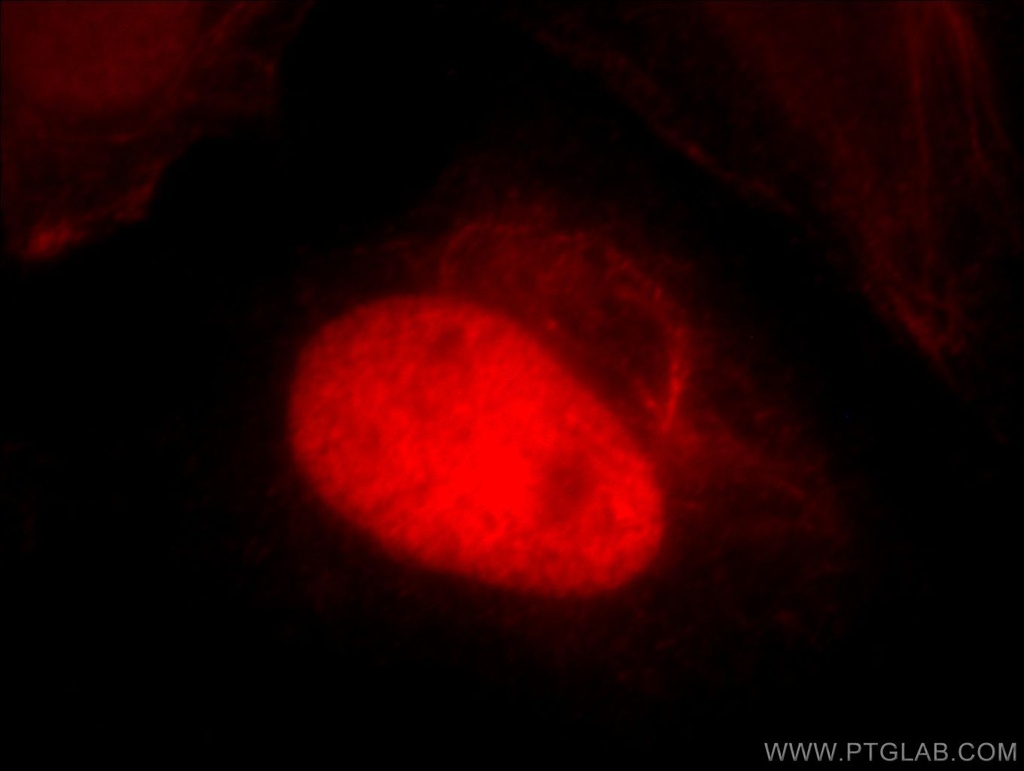 HTATSF1 Polyclonal antibody