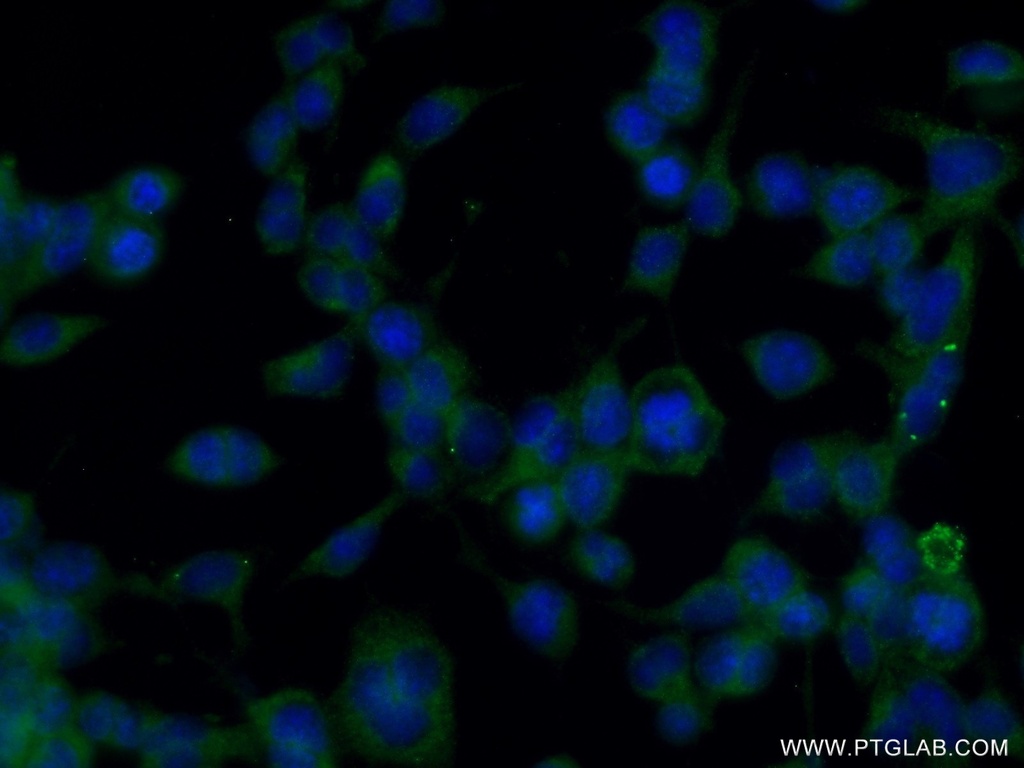 SHD Polyclonal antibody