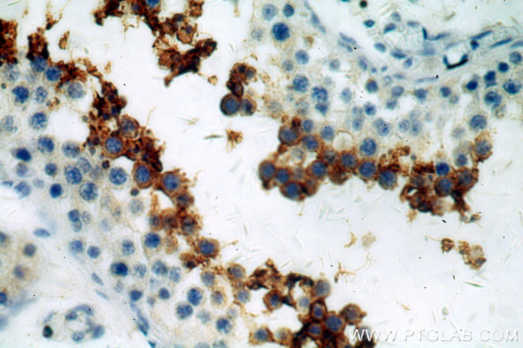 GLIPR1L1 Polyclonal antibody