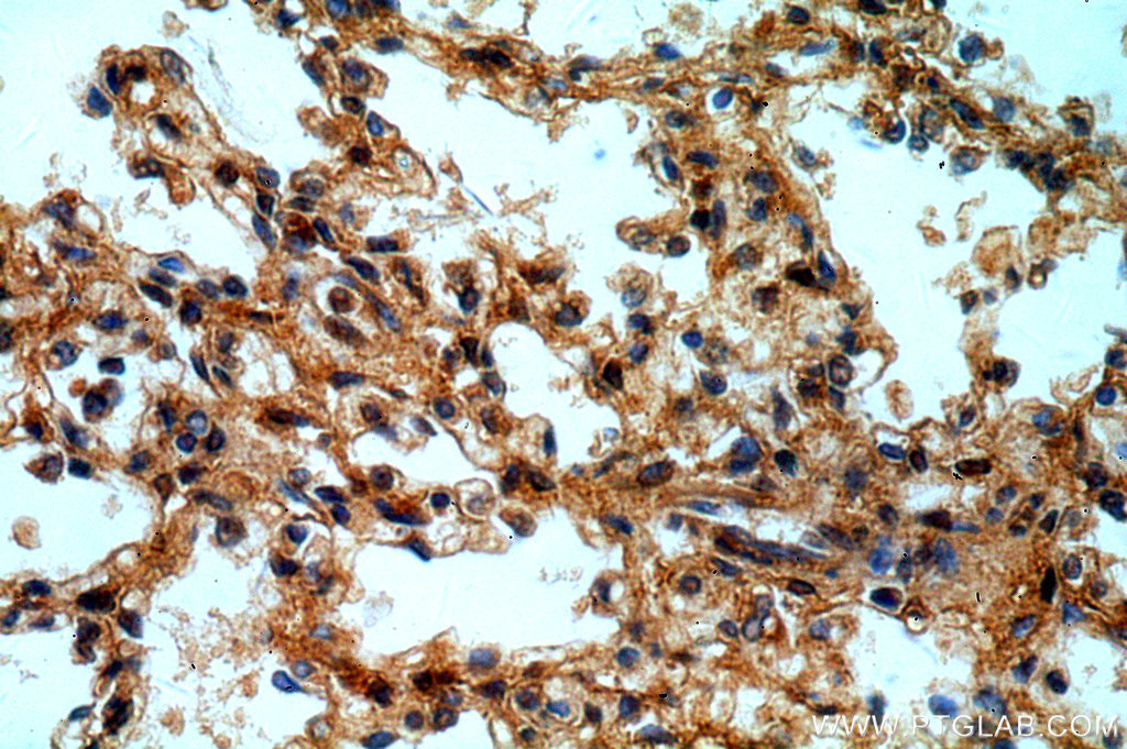 CXorf22 Polyclonal antibody