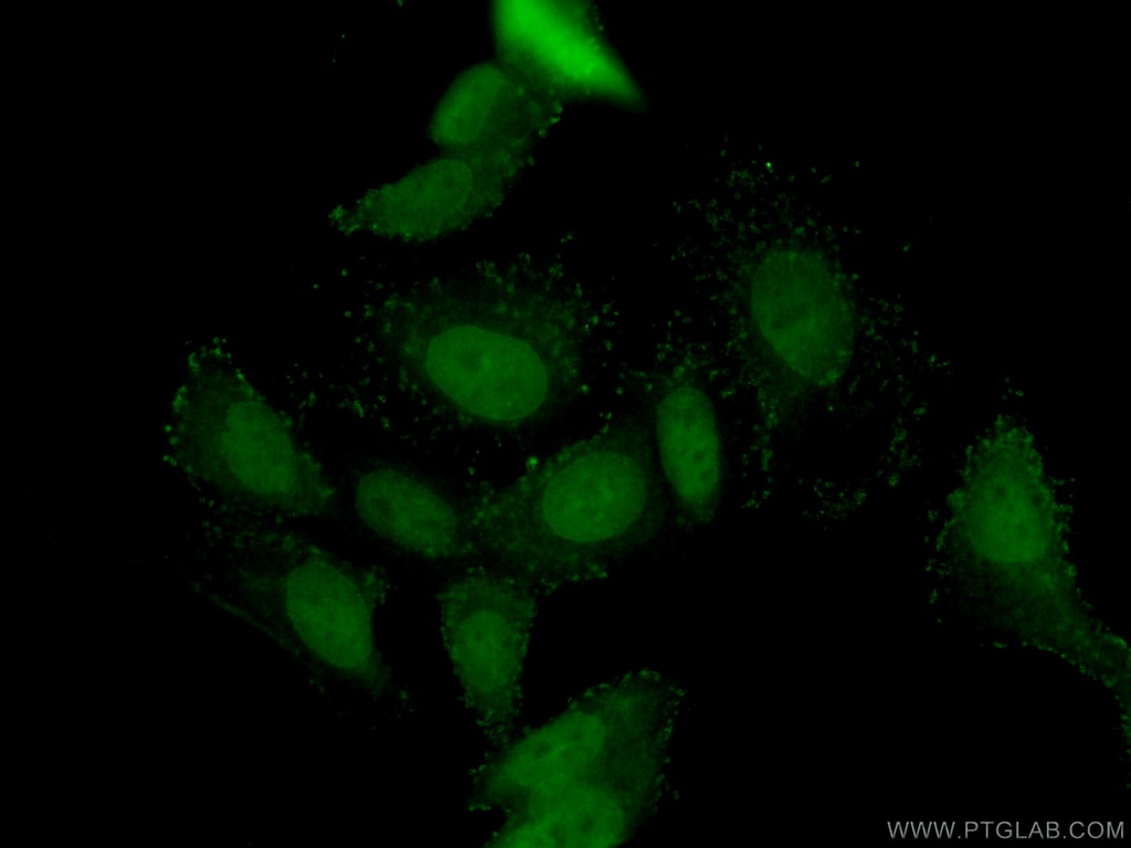 DAX-1 Polyclonal antibody