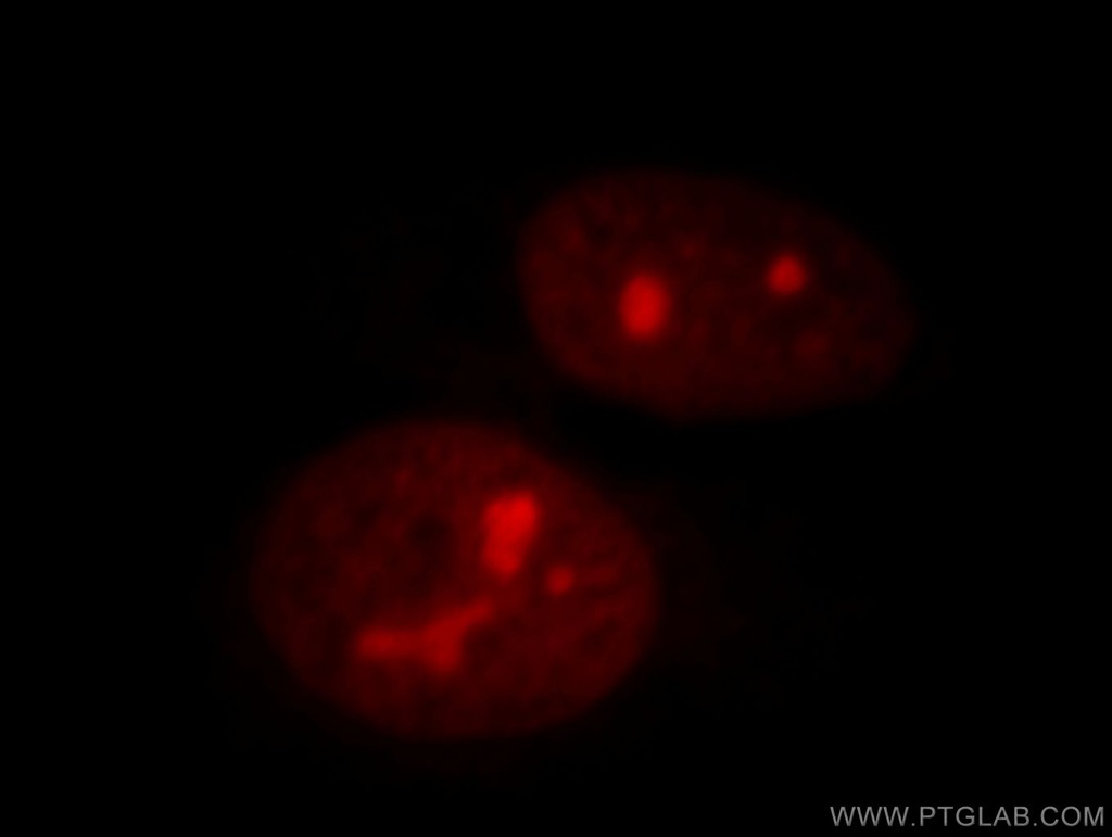 NSUN2 Polyclonal antibody