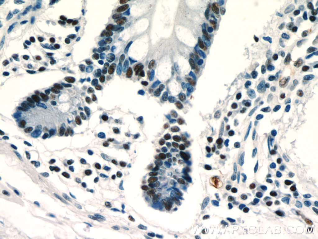 ZSCAN20 Polyclonal antibody