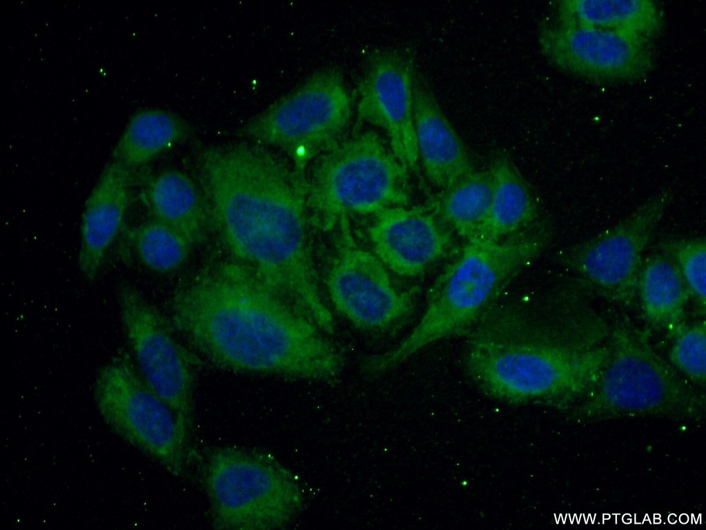 TFPI Polyclonal antibody