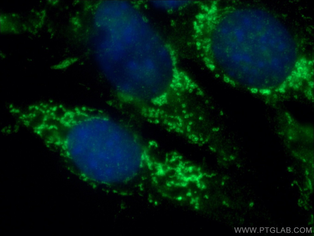 BRAF Polyclonal antibody
