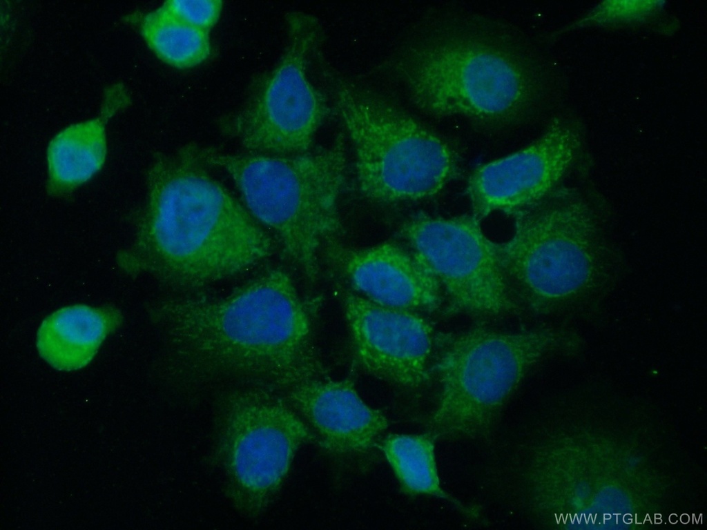 ACBD4 Polyclonal antibody