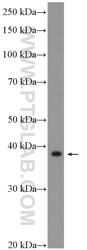 SAP30BP Polyclonal antibody