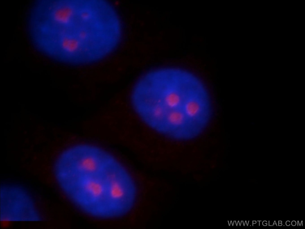 ABHD14B Polyclonal antibody