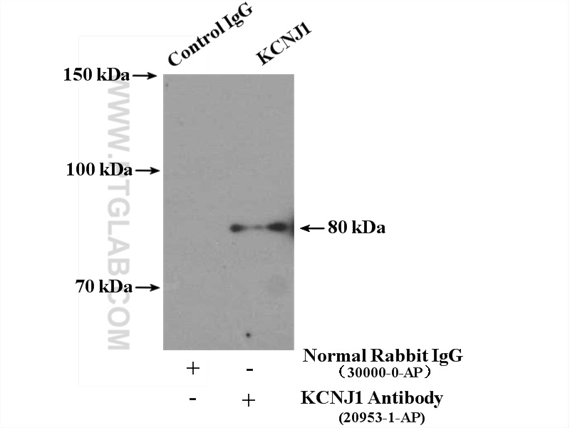 KCNJ1 Polyclonal antibody