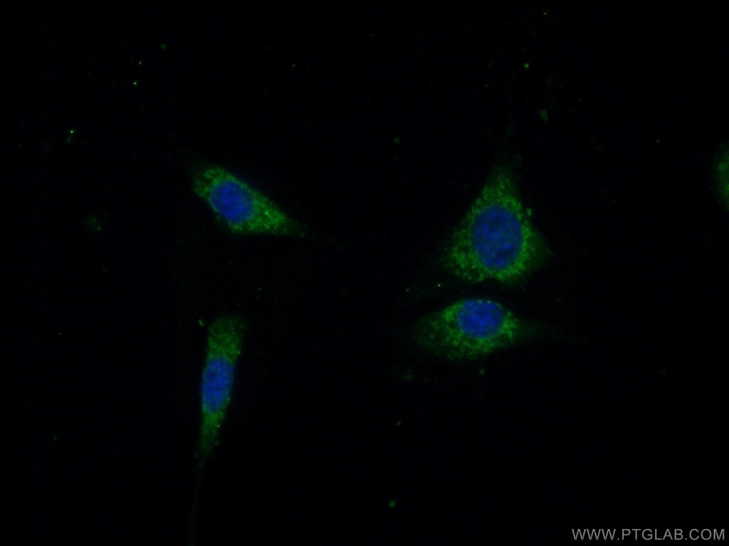 OTUD5 Polyclonal antibody