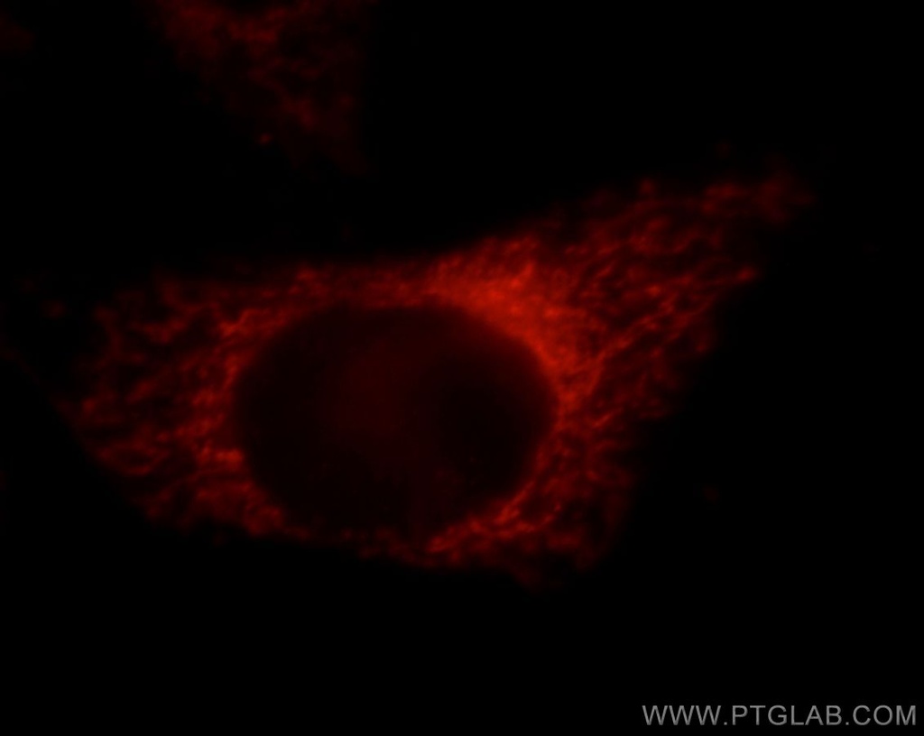 PDXDC1 Polyclonal antibody