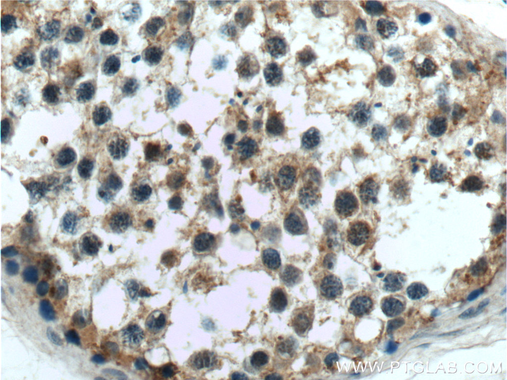 C9orf98 Polyclonal antibody