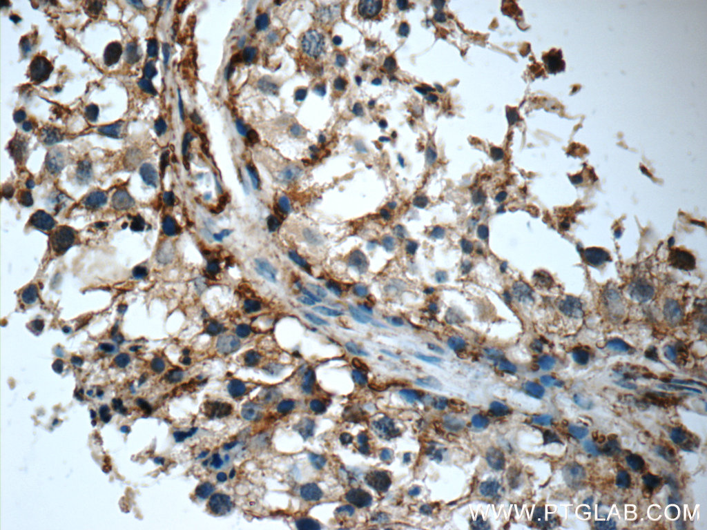 TMX3 Polyclonal antibody