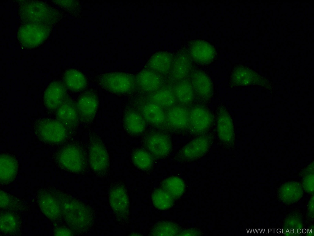 PML Polyclonal antibody