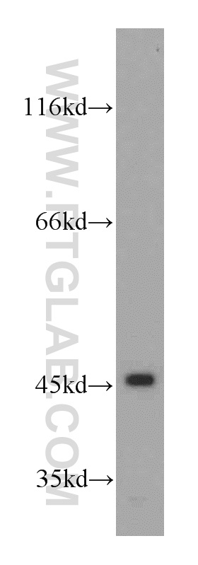 NR1I3 Polyclonal antibody