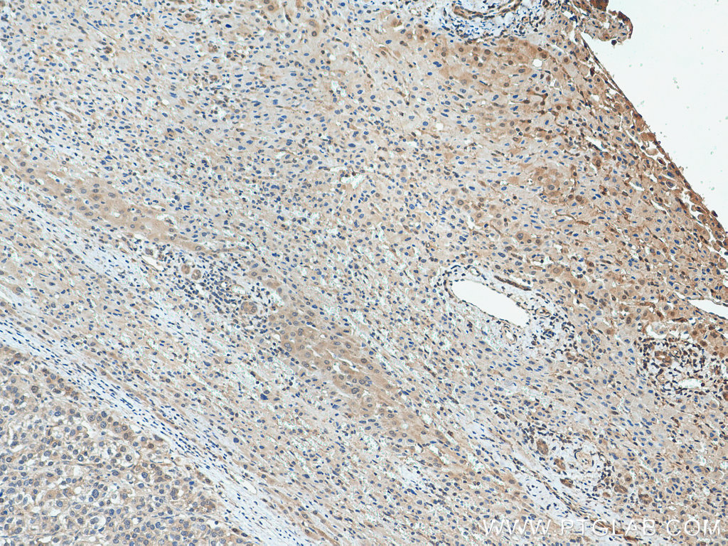 PNO1 Polyclonal antibody