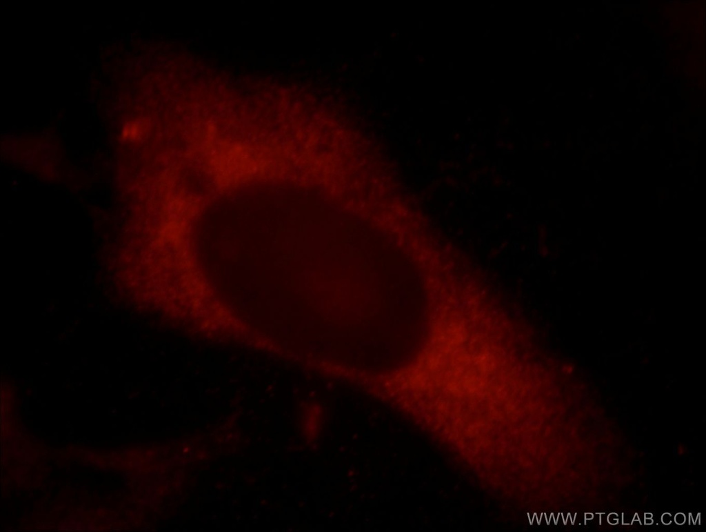 Synaptopodin Polyclonal antibody