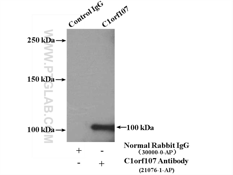 C1orf107 Polyclonal antibody