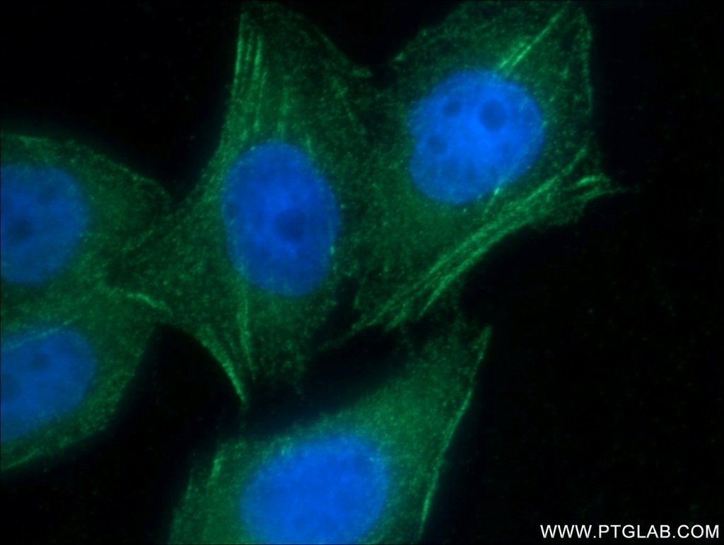 AFAP1 Polyclonal antibody