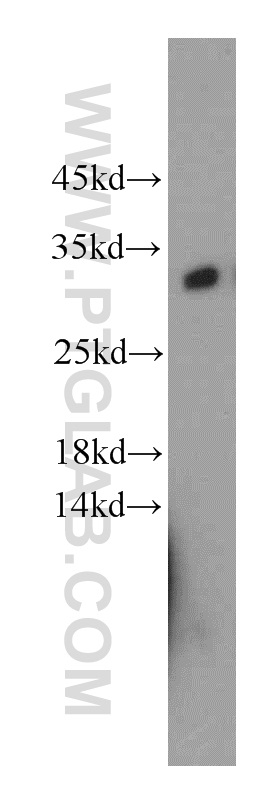 KCTD14 Polyclonal antibody