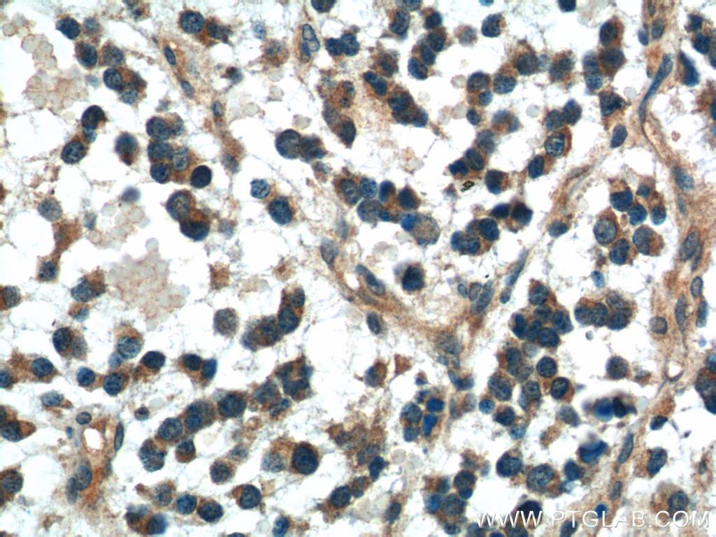 DKK1 Polyclonal antibody