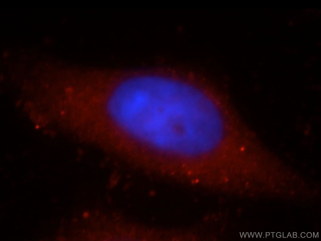 KIAA1199 Polyclonal antibody