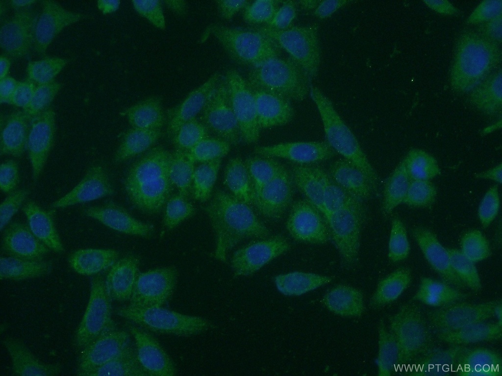 MAN2A1 Polyclonal antibody