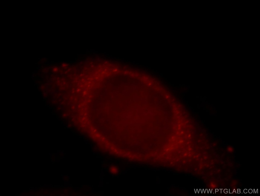 KIAA0528 Polyclonal antibody