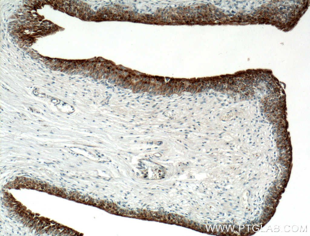 UPK2 Polyclonal antibody