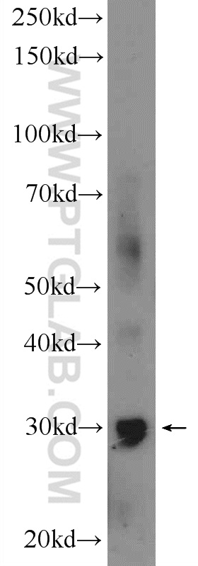 GIYD2 Polyclonal antibody