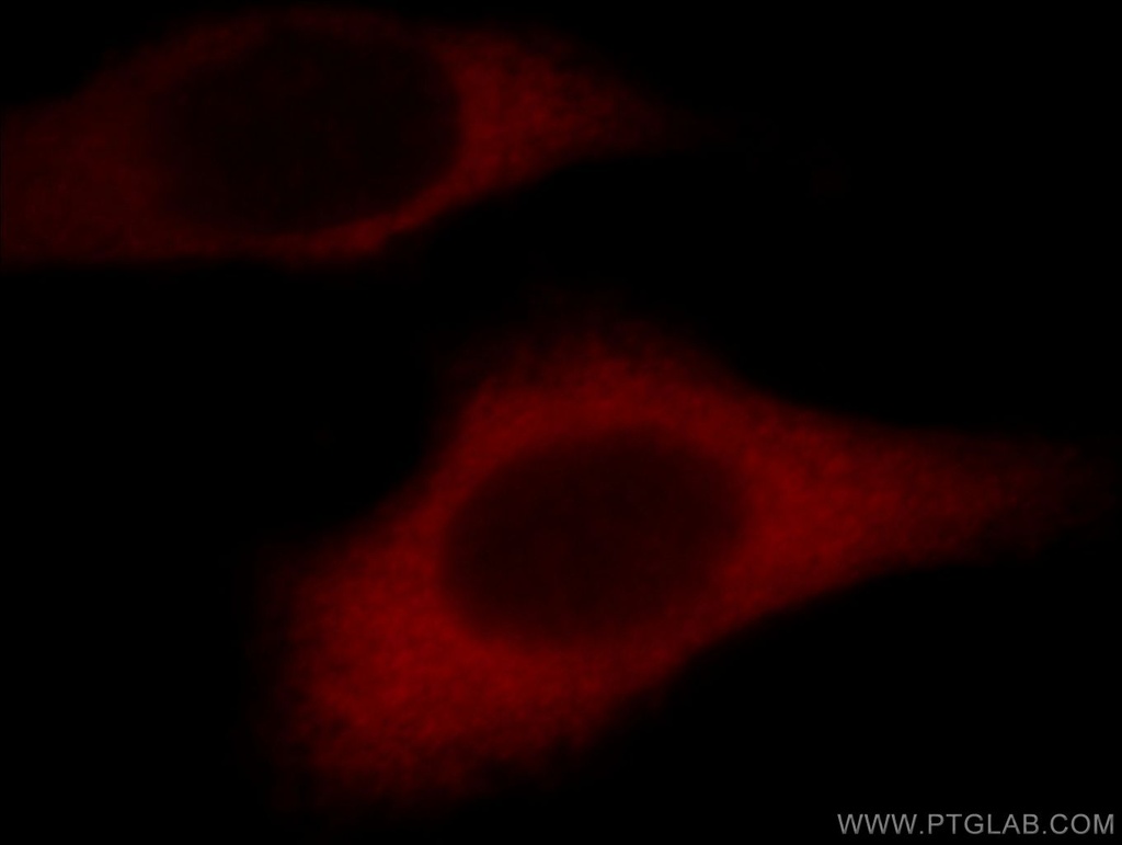 TRIP6 Polyclonal antibody