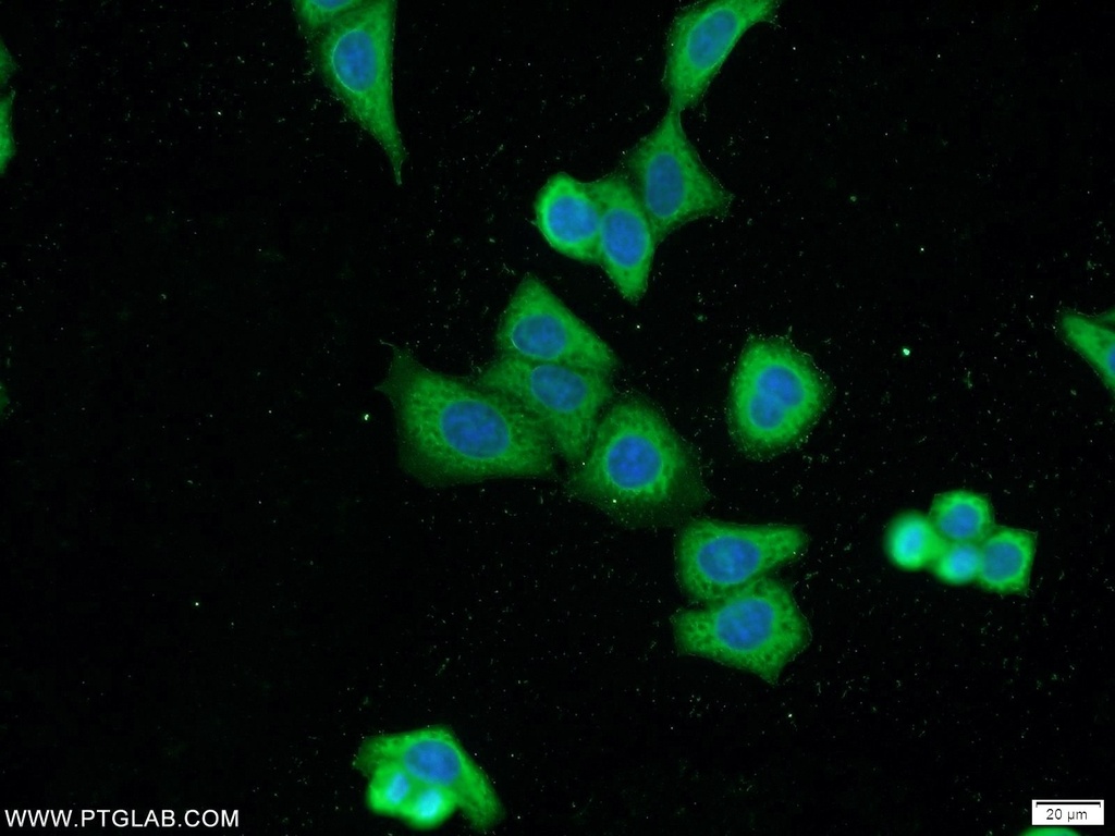 MKL1 Polyclonal antibody