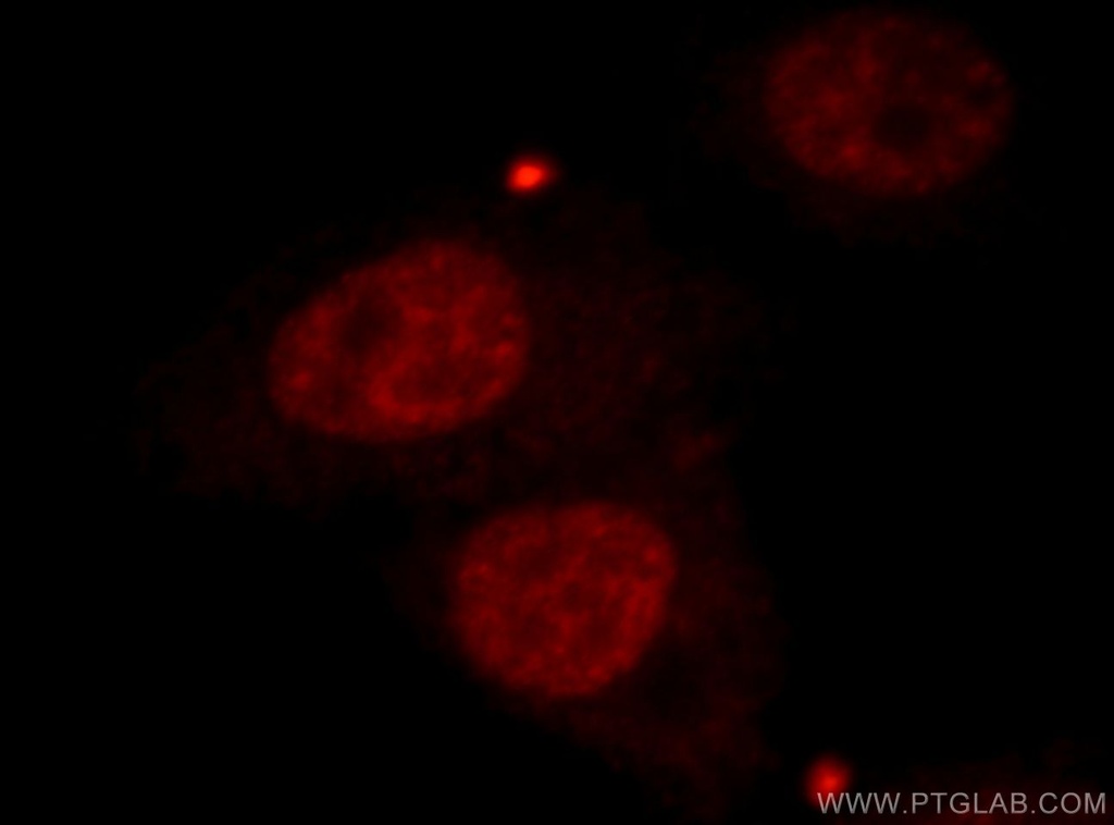 CBLL1 Polyclonal antibody