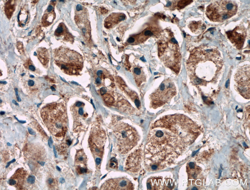 C11orf57 Polyclonal antibody