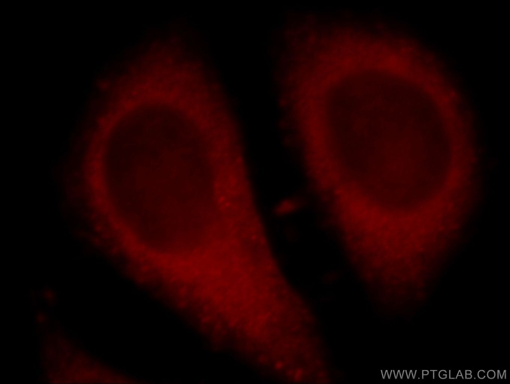 C13orf18 Polyclonal antibody