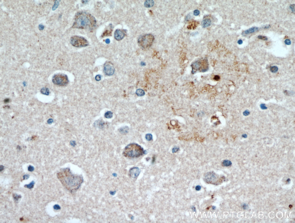KLHL4 Polyclonal antibody
