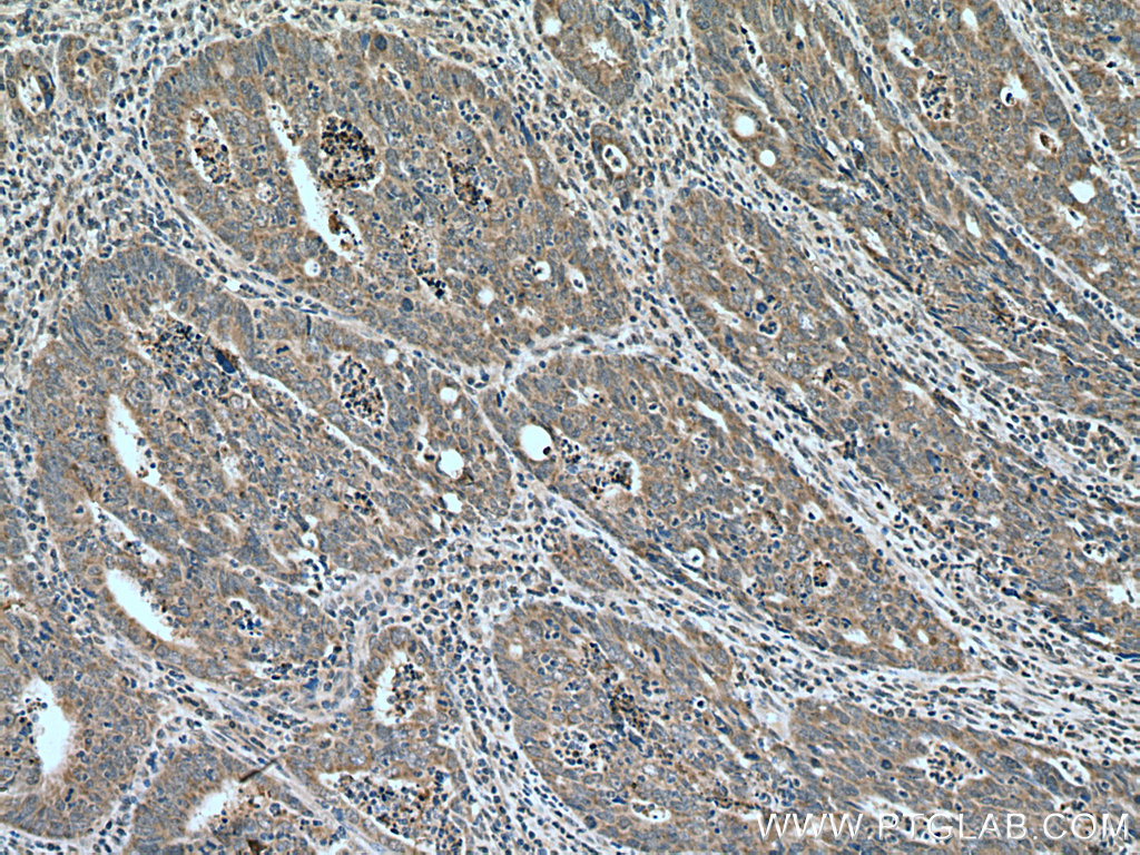 FAM72 Polyclonal antibody