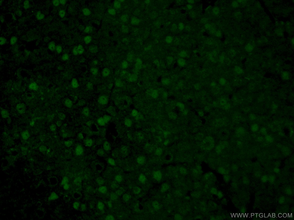 ATOH1 Polyclonal antibody