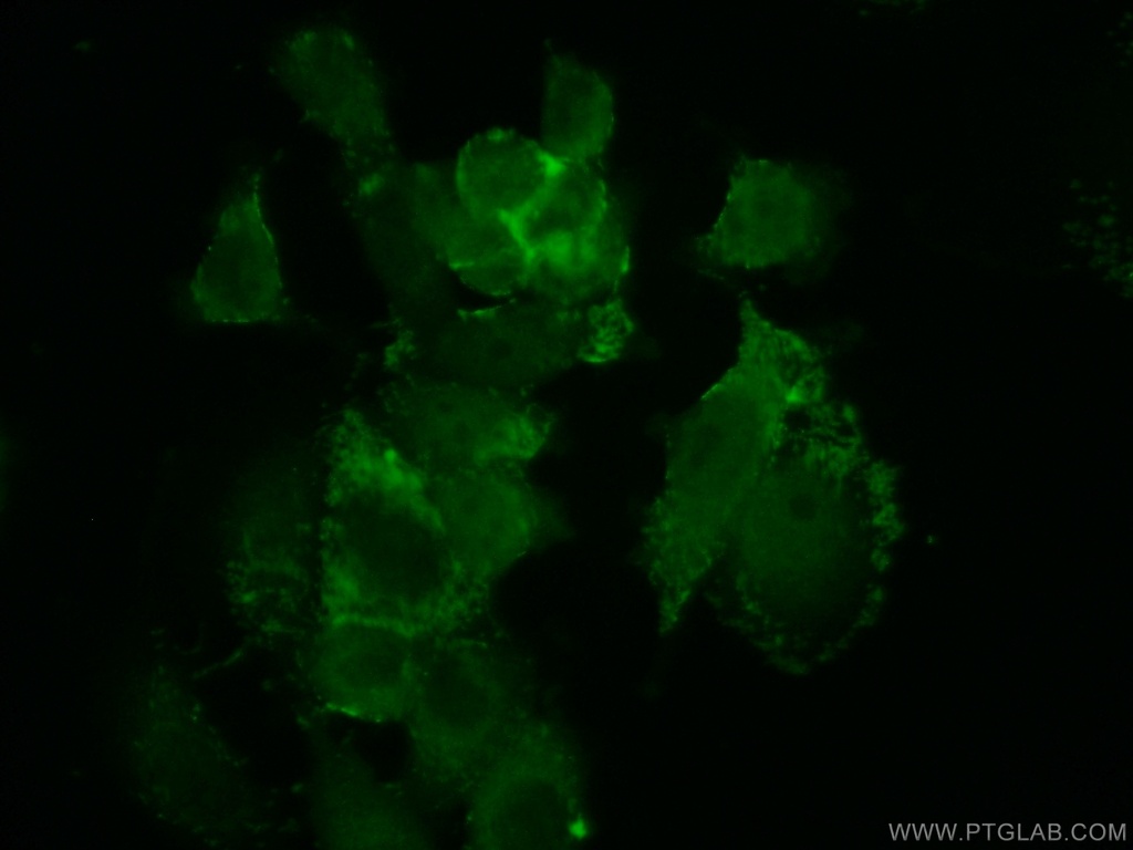AAMP Polyclonal antibody