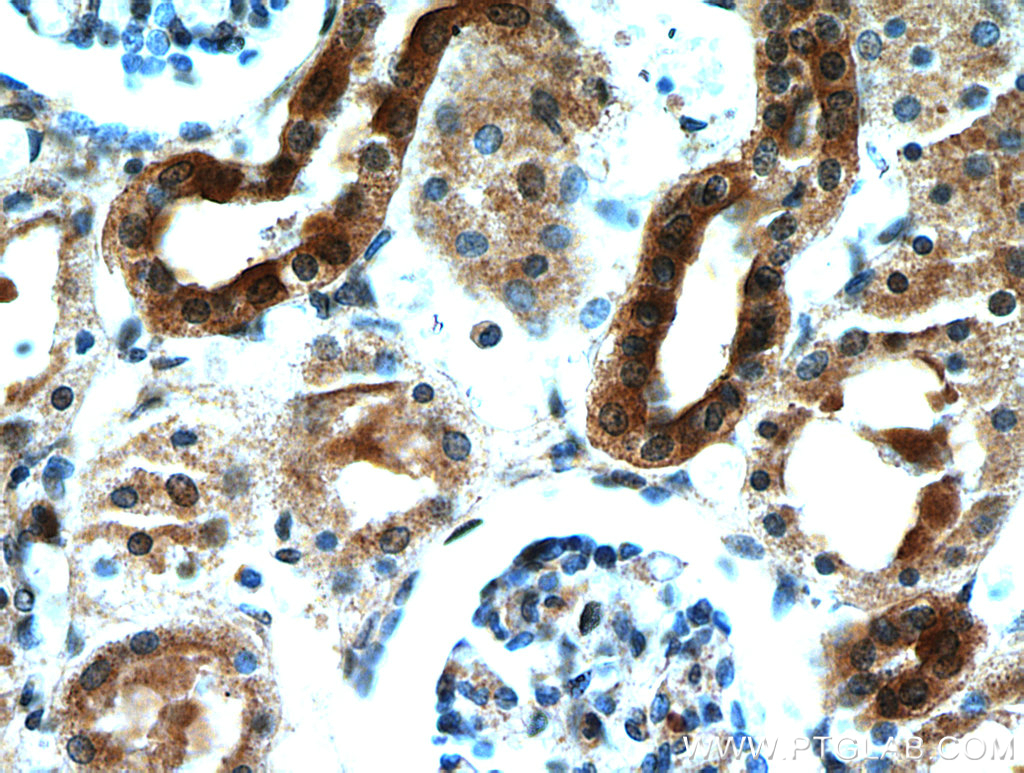 KCNQ1DN Polyclonal antibody
