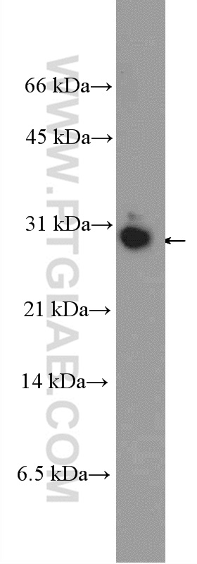 HMGB3L1 Polyclonal antibody
