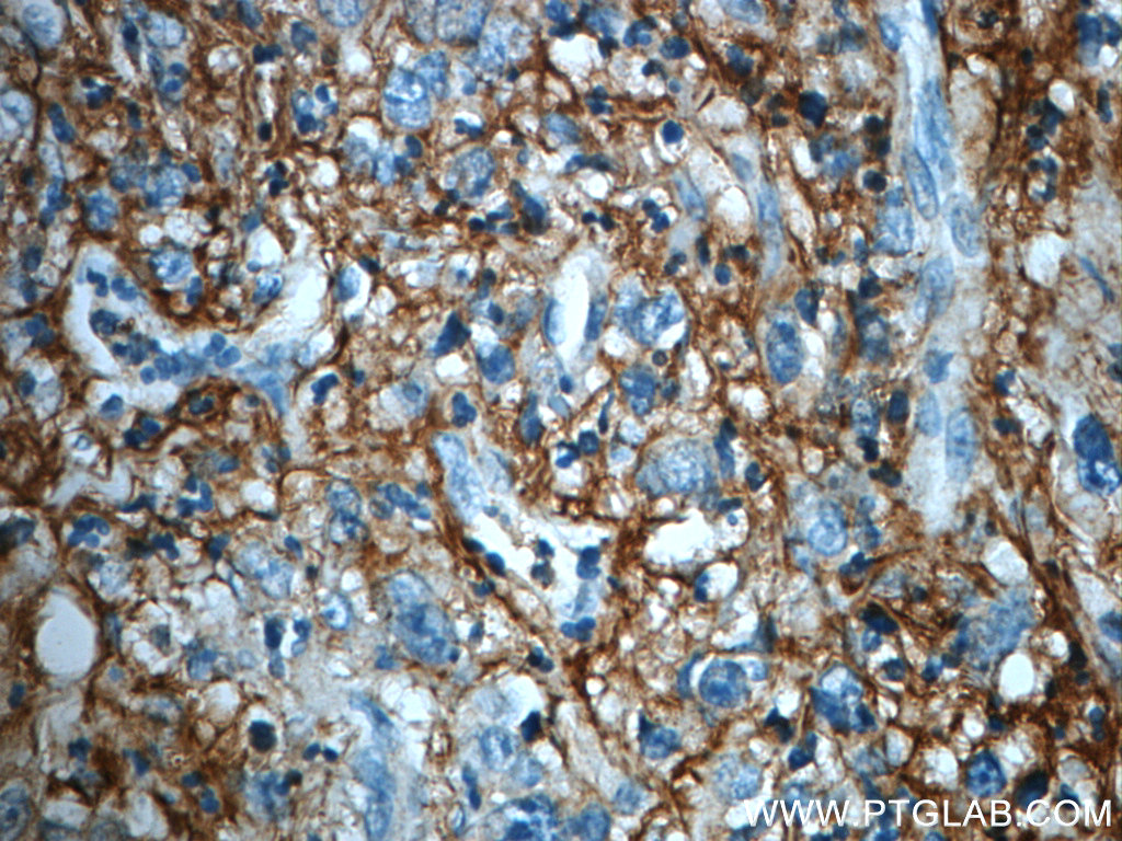 ITIH3 Polyclonal antibody