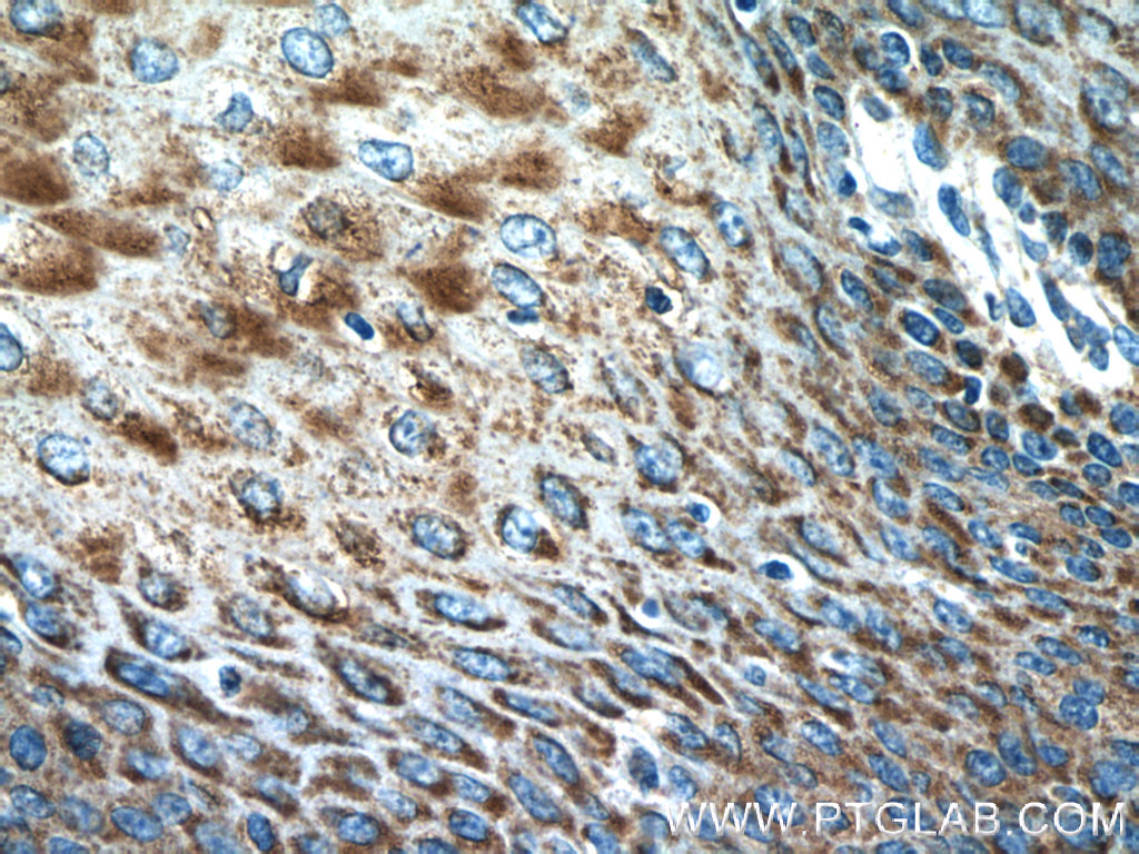 IL-36 Gamma Polyclonal antibody