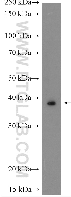 WISP3 Polyclonal antibody