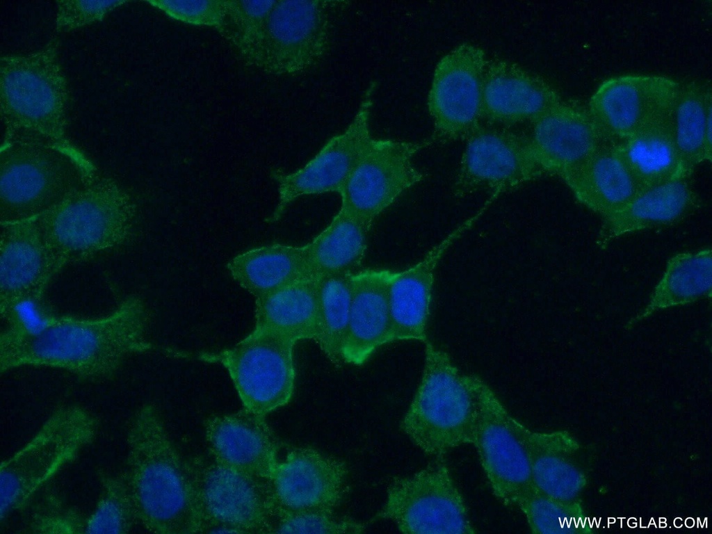 AMIGO3 Polyclonal antibody