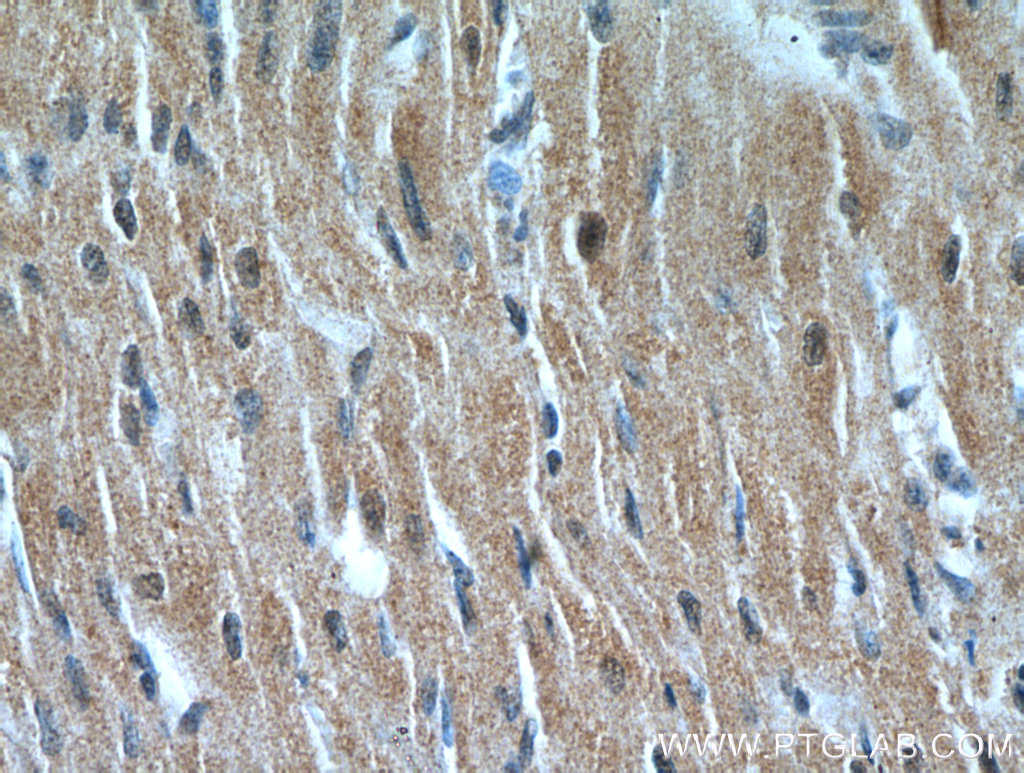 NHLRC1 Polyclonal antibody