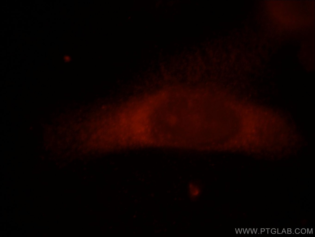 FAM124B Polyclonal antibody