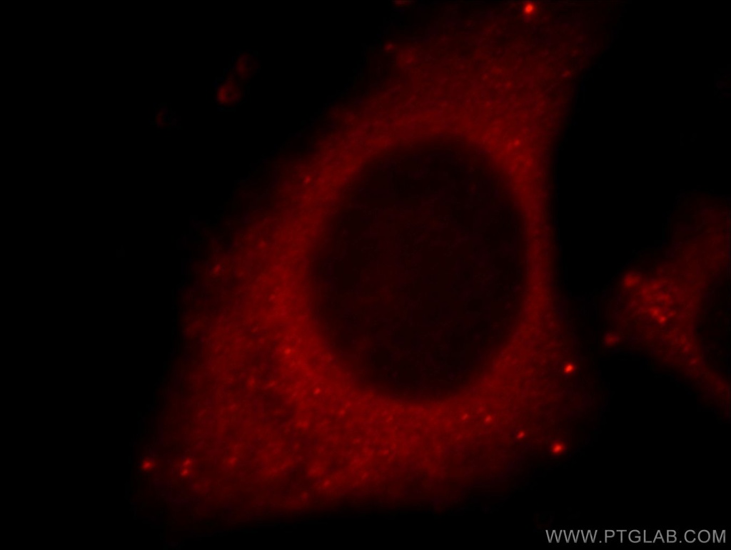 Cathepsin D Polyclonal antibody